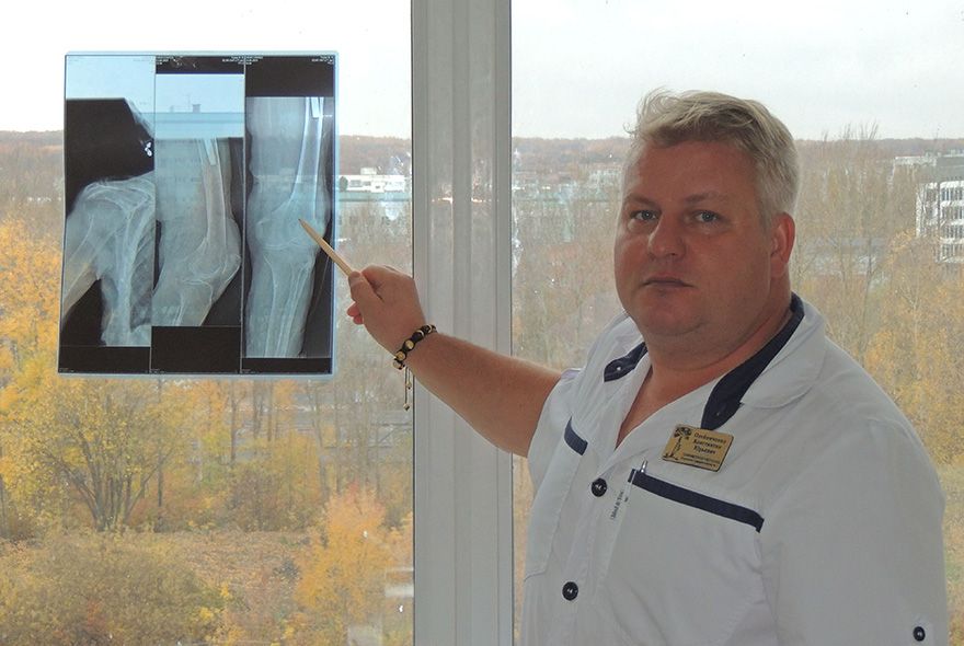  «Фарфоровые» кости